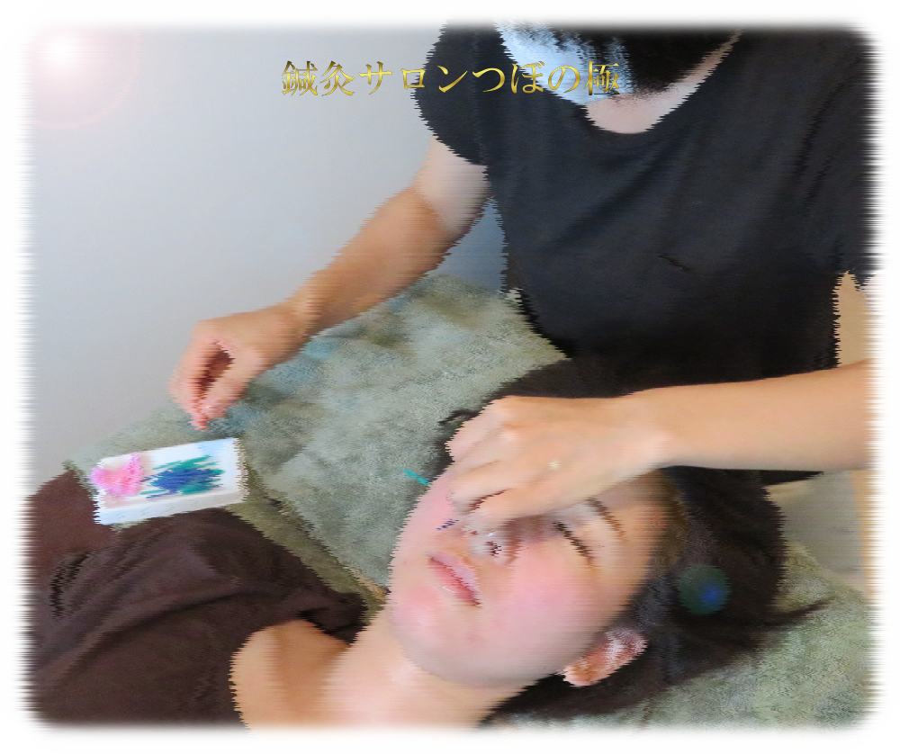 ENDELEX鍼灸サロンつぼの極美容鍼施術1